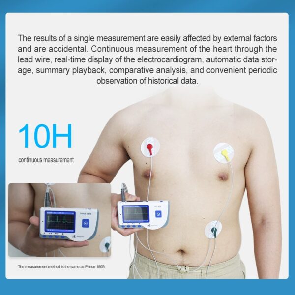 Registrar y almacenar señales de ECG de la derivación I, y mostrar la frecuencia cardíaca para uso en el cuidado de la salud en el hogar.