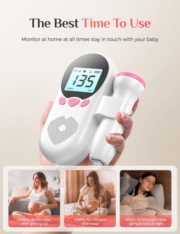Medstar Doppler Fetal Automático, Monitor, Ultrasonido Fetal