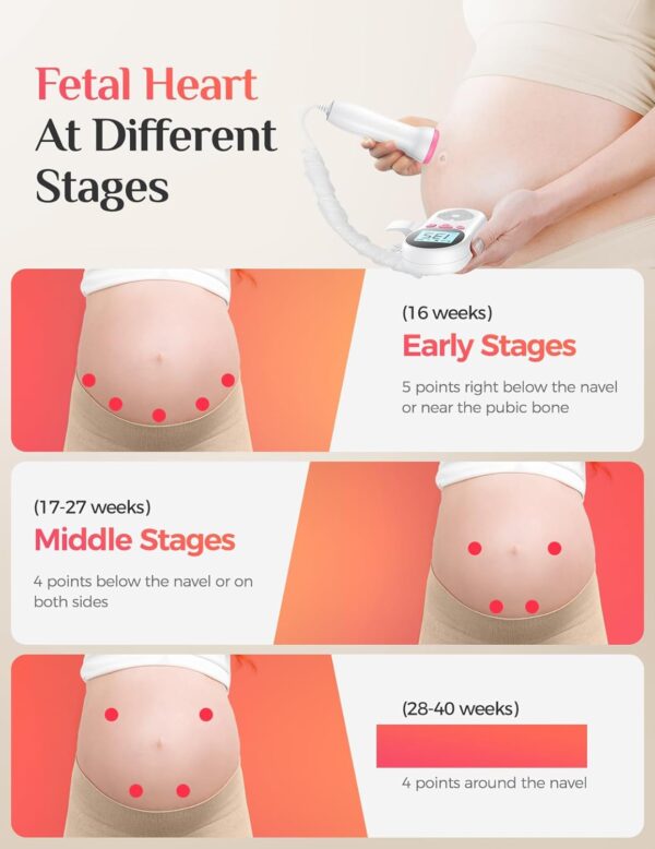 Medstar Doppler Fetal Automático, Monitor, Ultrasonido Fetal