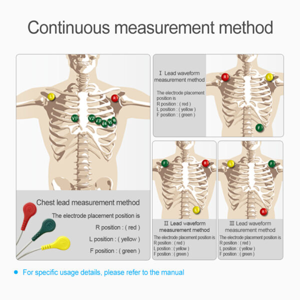 Registrar y almacenar señales de ECG de la derivación I, y mostrar la frecuencia cardíaca para uso en el cuidado de la salud en el hogar.